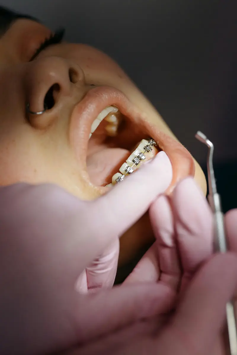 Ortodoncia Especializada con el Dr. José Herrera
